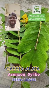 Cassia Alata #herbs #nature #arthritis | Dr-Roots Agunbiade