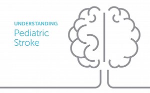 23 reactions · 3 comments | Get your copy of the Understanding Pediatric Stroke e-book, from Boston Children's Hospital! | Boston Children’s Hospital | Facebook