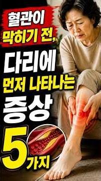 다리에 이런 증상 있다면 혈관이 위험합니다｜5가지 경고 신호