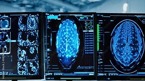 A doctor examines comprehensive knee scans, including MRI and bone CT images, on cutting-edge medical equipment in a busy radiology orthopedic unit.