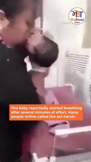 Doctor Revived a New Born Baby after giving mouth to mouth resuscitation #mouthtomouthresuscitation