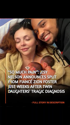 NewsTigo on Instagram: "Little Mix star Jesy Nelson confirms split from fiancé just weeks after announcing twin daughters' heartbreaking diagnosis The former Little Mix star has left fans absolutely devastated after confirming that her relationship with fiancé Zion Foster has come to a sudden end during what she calls the "darkest period" of her life. The split comes at a time when the 34-year-old singer is already facing every parent’s worst nightmare. Just weeks ago, Jesy shared the "shatterin