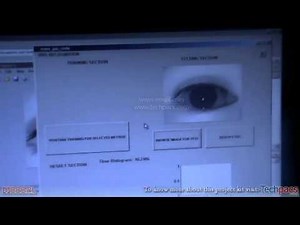 IRIS Based Secure Access | IRIS Scan System | Biomertic Identification using Arduino (latest)