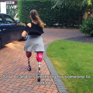 Think life is being unfair to you? Need some motivation to get you back on track? Watch this video to see how 14 year old Isabelle, a girl who had both her arms and legs amputated due to Meningitis, has risen above her problems and found her own way around her. Meningitis is a rare infection in which membranes covering the brain and spinal cord undergo acute inflammation. This is caused by viruses, bacteria and fungi. Share this video with someone you think could use some motivation right now! (