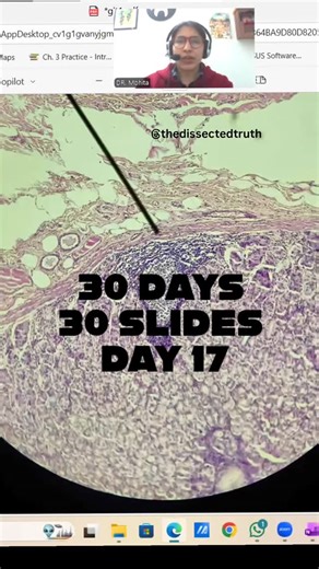 Dr. Mohita Sachdeva on Instagram: "30 Days 30 slides challenge day 17. This is a slide of MALT/GALT . . #studygram #histology #collegelife #medicalmarijuana"