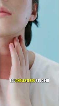 One Neck Trick Drops Cholesterol 17% in 6 Weeks