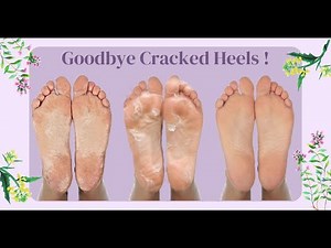 Peeling & Exfoliating Foot Mask - LuxaDerme
