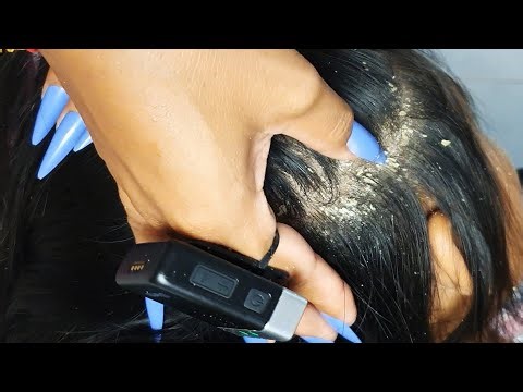 Super Close Scalp Scratch Session 🌙 | Heavy Flakes, Long Nails & Tingle Relief #VF0040