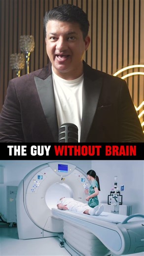 Man Living Without Brain Real Medical Case That Shocked Doctors