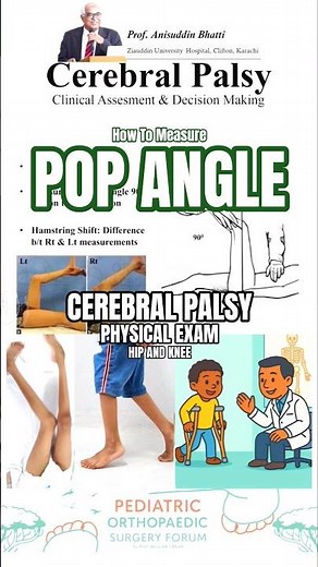 How To Measure POPLITEAL ANGLE For Tight Hamstring in Cerebral Palsy #Cerebralpalsy #doctor #ortho