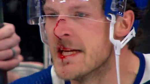 Maple Leafs’ McCabe, Keefe incensed after late hit by Stars’ Marchment