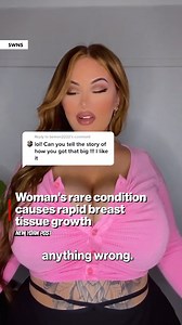 18K views · 35 reactions | A woman has told how she has natural P-cup breasts which won’t stop growing due to a rare condition. | New York Post Health & Parenting | Facebook