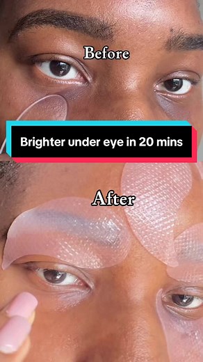 Brighten Your Eyes with This Amazing Eye Patch