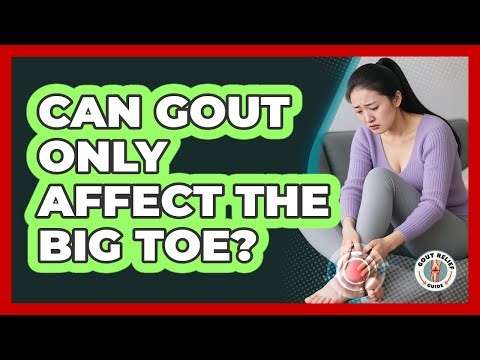 Can Gout Only Affect the Big Toe?