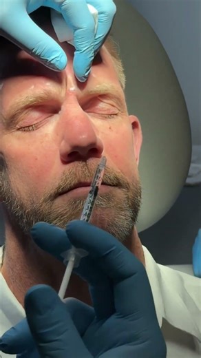 Understanding Male Botox 💪 | The Key to Confident Aesthetic Results | Learn Anytime with IAPAM