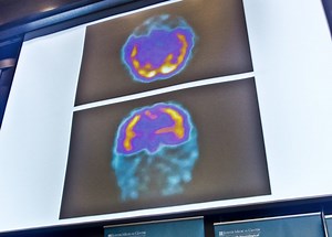 Teaching Parents — And Kids — About Post-Concussion Recovery