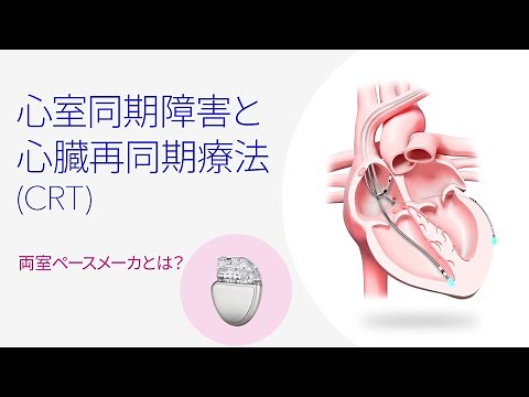 心室同期障害と心臓再同期療法（CRT） ペースメーカと両室ペースメーカの違い