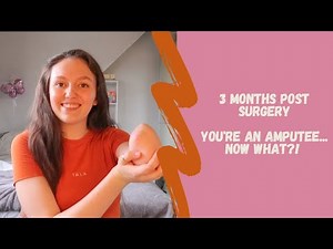 YOU'RE AN AMPUTEE... NOW WHAT?!