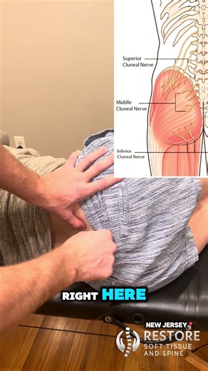 Fixing #backpain #backpainrelief #herniateddisc