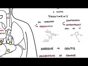 Amebiasis - Entamoeba Histolytica Symptoms, Pathophysiology, Diagnosis, Treatment • Video • MEDtube.net