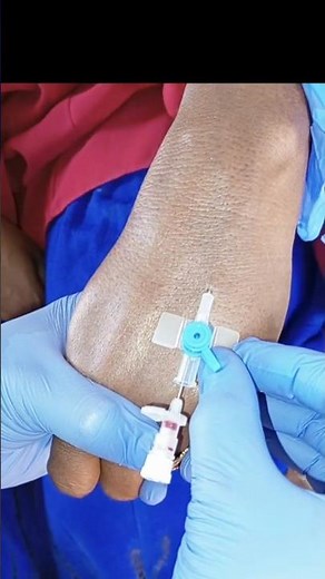 IV Cannulation Technique #ivinsertion #ivcannulation #nursingskills #training #youtubeshorts