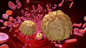 Pourquoi Erytech Pharma s’envole en Bourse