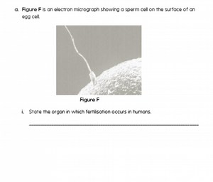 a. Figure F is an electron micrograph showing a sperm cell on t... | Filo