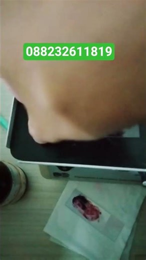 Get Positive Gonorrhea Samples for Only 50k Per Slide