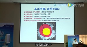 1.PCI与IVUS-IVUS基础读图及测量快速入门