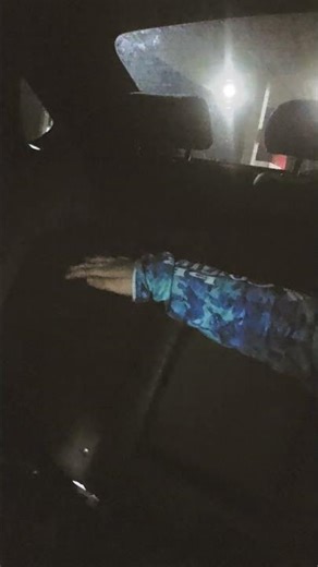 my finger fell off #trend