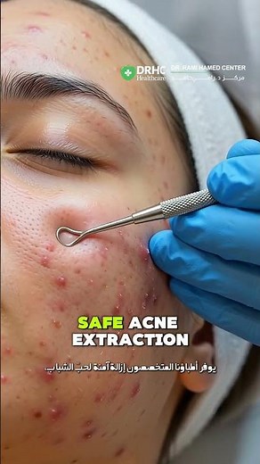 Stop Squeezing Pimples: Prevent Acne Scars | DRHC Dubai