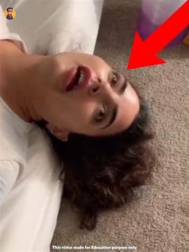 😱Why do they sleep with their eyes open⁉️