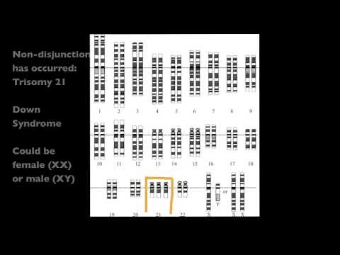 4.2.7 Analyze a human karyotype to determine gender and whether non-disjunction has occurred