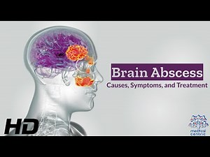 Brain Abscess Unveiled: Causes, Symptoms, and Lifesaving Treatments