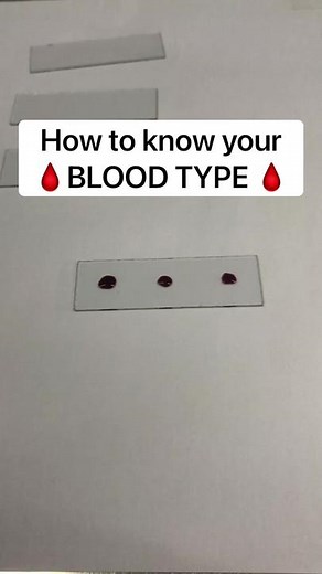 Discovering Your Blood Type: How to Identify Your Blood Group