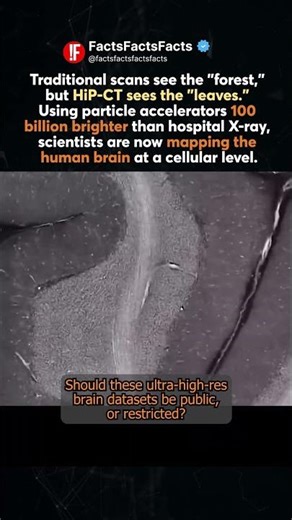 Seeing the Invisible! 🧠 The HiP-CT Medical Revolution 🏥