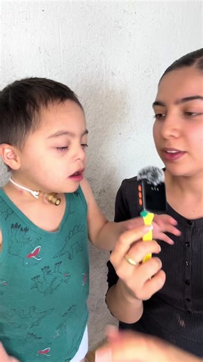 Traqueotomía y Apnea en Bebés: Cuidado y Descanso