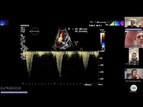 Left Ventricular Dynamic Obstruction