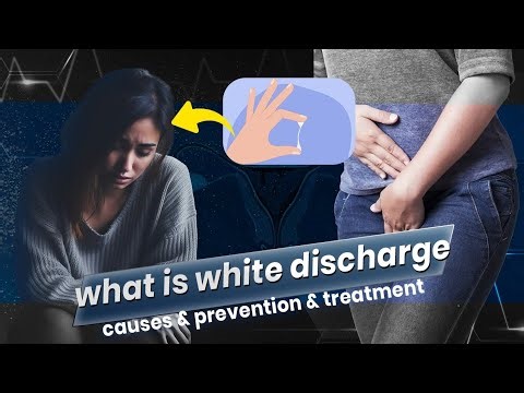 What is white discharge | causes, prevention, treatment