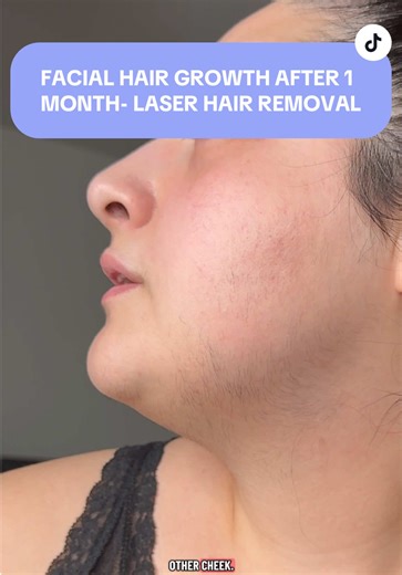 Facial Hair Growth After One Month Without Shaving