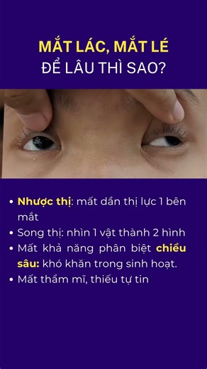 Mắt lác để lâu thì sao? #matlac #delau