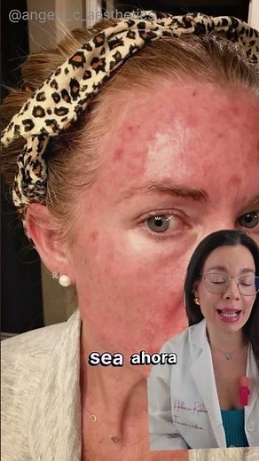 This is what happens when you abuse the sun for years 😱