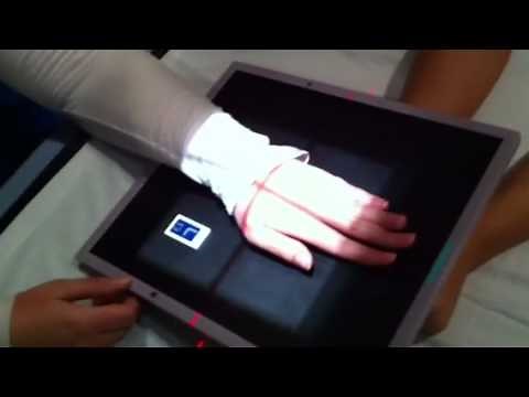 Xray - Wrist (Stecher Method)