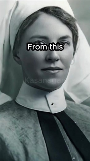 Mary Ann Bevan was once a beautiful and happy woman, but her life changed forever when she developed acromegaly, a rare disorder that caused her facial features and hands to grow abnormally large. Once a hardworking nurse and loving mother, she was left widowed and struggled to support her children. Desperate to provide for them, she made the heartbreaking decision to join a circus sideshow as the