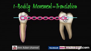 Types of Orthodontic Tooth movement on Make a GIF