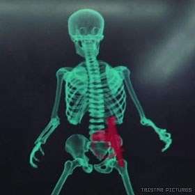 The physics and biology of the TSA's backscatter security scanners