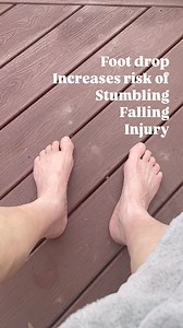 16K views · 61 reactions | Foot drop is a common occurrence in people...