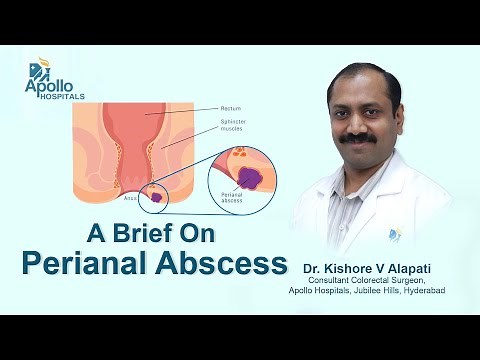 Perianal Abscess | Dr Kishore V Alapati | Colorectal Surgeon | Apollo Hospital Hyderabad