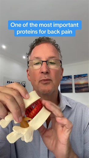 30K views · 363 reactions | #herniateddisc #backpain #backpains #foryou #sciatica #herniateddiscs #herniateddiskbackpain #selfcare | High Performance Spine | Facebook