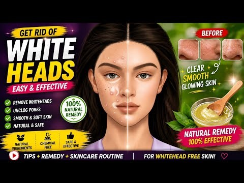 How to Remove Whiteheads at Home | Easy Skincare Routine for Clear & Smooth Skin |